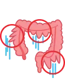 Colon dilation
