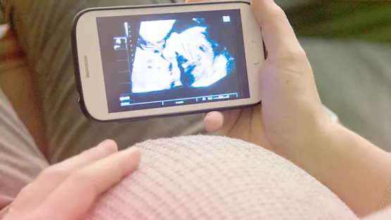 Pregnant woman viewing the baby ultrasound scan in mobile phone