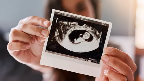 Ultrasound scan shown by woman of her child